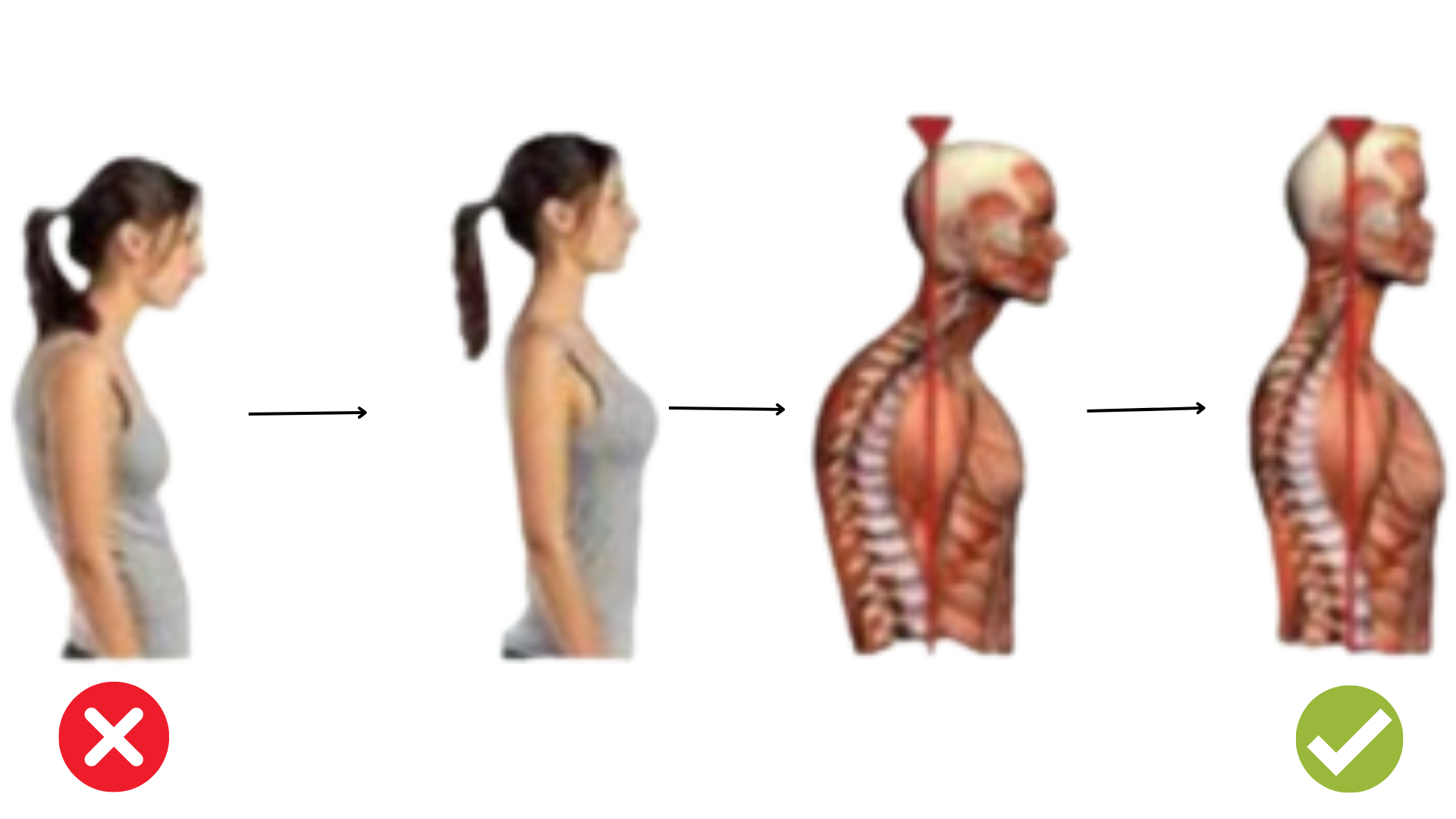 CORRECTOR DE POSTURA CON SENSOR INTELIGENTE + ENVÍO GRATIS